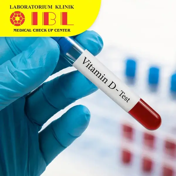 Cek status Vitamin D 25-OH